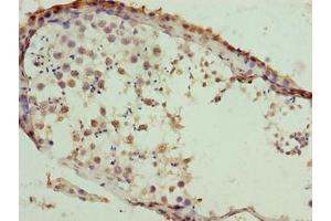 Immunohistochemistry of paraffin-embedded human testis tissue using ABIN7171798 at dilution of 1:100 (SLC26A8 antibody  (AA 414-595))