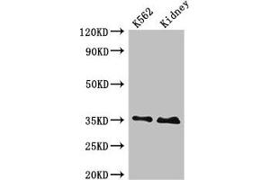 Western Blot Positive WB detected in: K562 whole cell lysate, Rat kidney tissue All lanes: TRADD antibody at 4 μg/mL Secondary Goat polyclonal to rabbit IgG at 1/50000 dilution Predicted band size: 35, 28 kDa Observed band size: 35 kDa (TRADD antibody  (AA 1-312))
