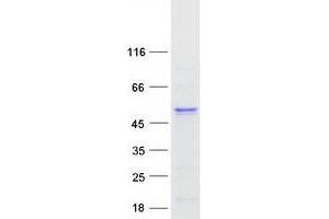 Validation with Western Blot (TXNDC5 Protein (Transcript Variant 2) (Myc-DYKDDDDK Tag))