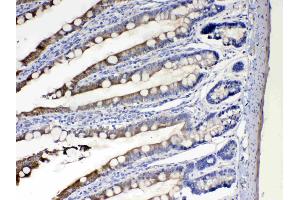 IHC analysis of Cytochrome P450 2D6 using anti- Cytochrome P450 2D6 antibody . (CYP2D6 antibody  (C-Term))