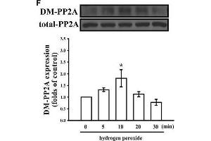 Western Blotting (WB) image for anti-Protein Phosphatase 2, Catalytic Subunit, alpha Isozyme (PPP2CA) (C-Term) antibody (ABIN2856333)