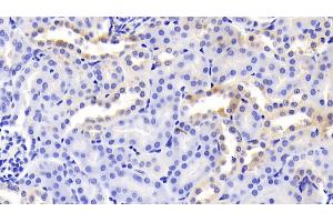 Detection of HOP in Mouse Kidney Tissue using Polyclonal Antibody to Homeodomain Only Protein (HOP) (HOPX antibody  (AA 11-73))