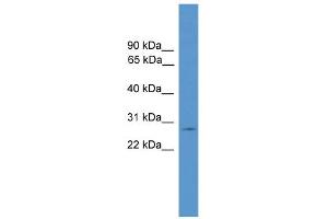 WB Suggested Anti-CLRN1 Antibody Titration: 0. (Clarin 1 antibody  (C-Term))