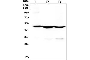 Western blot analysis of Cytokeratin 18 using anti-Cytokeratin 18 antibody (ABIN7600573). (Cytokeratin 18 antibody  (AA 204-430))