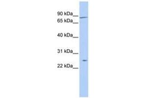 Image no. 1 for anti-Zinc Finger Protein 613 (ZNF613) (AA 108-157) antibody (ABIN6742641) (ZNF613 antibody  (AA 108-157))