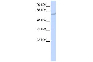 WB Suggested Anti-ZBTB7A Antibody Titration:  0. (ZBTB7A antibody  (N-Term))
