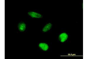 Immunofluorescence of purified MaxPab antibody to AFF4 on HeLa cell. (AFF4 antibody  (AA 1-365))