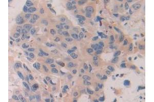 Immunohistochemistry (IHC) image for anti-Chordin (CHRD) (AA 700-918) antibody (ABIN7442051)