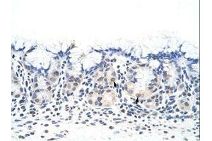 Image no. 2 for anti-Deleted In Azoospermia 4 (DAZ4) (N-Term) antibody (ABIN6736264) (DAZ4 antibody  (N-Term))