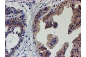 Immunohistochemical staining of paraffin-embedded Human breast tissue using anti-EIF4E2 mouse monoclonal antibody.