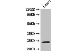 Western Blot Positive WB detected in: Mouse heart tissue All lanes: TIMP1 antibody at 2 μg/mL Secondary Goat polyclonal to rabbit IgG at 1/50000 dilution Predicted band size: 24 kDa Observed band size: 24 kDa