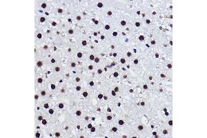 Immunohistochemistry of paraffin-embedded rat liver using BRMS1 Rabbit mAb (ABIN7265928) at dilution of 1:100 (40x lens). (BRMS1 antibody)