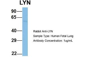 Host: Rabbit  Target Name: LYN  Sample Tissue: Human Fetal Lung  Antibody Dilution: 1. (LYN antibody  (N-Term))