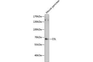 Western blot analysis of extracts of mouse pancreas, using CEL antibody (ABIN6132072, ABIN6138393, ABIN6138395 and ABIN6216837) at 1:3000 dilution. (Cholesterol Esterase antibody  (AA 350-550))