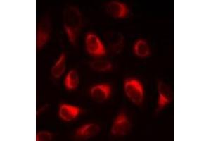 Immunofluorescent analysis of FABP5 staining in A549 cells. (FABP5 antibody)