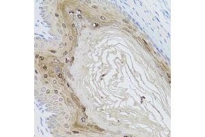 Immunohistochemistry of paraffin-embedded mouse stomach using AMBRA1 antibody (ABIN5970441) at dilution of 1/100 (40x lens). (AMBRA1 antibody)