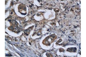 Immunohistochemistry (Paraffin-embedded Sections) (IHC (p)) image for anti-Legumain (LGMN) (AA 201-300) antibody (ABIN750958)