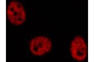 ABIN6274293 staining COLO205 cells by IF/ICC. (MLLT10 antibody  (Internal Region))