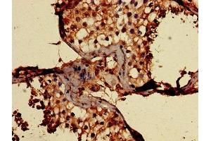 Immunohistochemistry of paraffin-embedded human testis tissue using ABIN7147167 at dilution of 1:100 (CD59 antibody  (AA 26-102))
