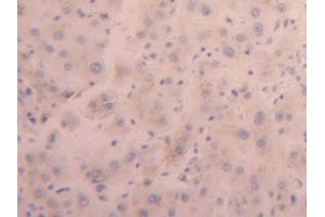 DAB staining on IHC-P; Samples: Human Liver Tissue (FURIN antibody  (AA 105-221))