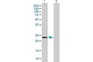 Western Blot analysis of GSTA2 expression in transfected 293T cell line by GSTA2 MaxPab polyclonal antibody. (GSTa2 antibody  (AA 1-222))