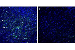 Expression of /LRRC4 in mouse cortex.
