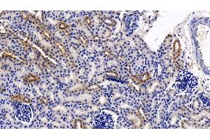 Detection of DDAH2 in Mouse Kidney Tissue using Polyclonal Antibody to Dimethylarginine Dimethylaminohydrolase 2 (DDAH2)