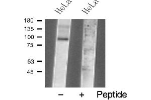 Western blot analysis of TM16J Antibody expression in Hela cells lysates. (ANO9 antibody  (Internal Region))