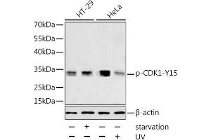 Western blot analysis of extracts of HT-29 and HeLa cells, using Phospho-CDK1-Y15 antibody (ABIN3019442, ABIN3019443, ABIN3019444 and ABIN6225371) at 1:1000 dilution. (CDK1 antibody  (pTyr15))
