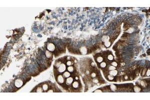ABIN6267297 at 1/100 staining Mouse intestine tissue by IHC-P. (ATP1A1 antibody  (pSer16))