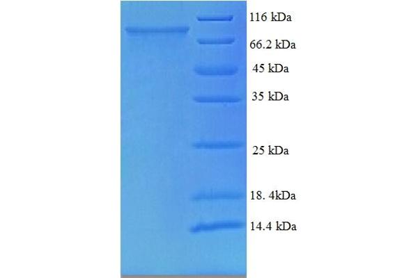 TCHP Protein (AA 1-498, full length) (His-SUMO Tag)
