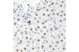 Immunohistochemistry of paraffin-embedded rat liver using PTBP1 antibody (ABIN5995415) at dilution of 1/100 (40x lens). (PTBP1 antibody)