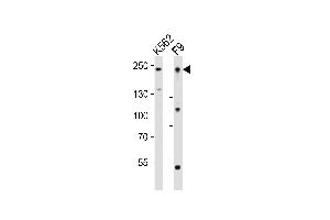 Western blot analysis of lysates from K562, mouse F9 cell line (from left to right), using Dnmt1 Antibody (Center) (ABIN6243160 and ABIN6577898). (DNMT1 antibody  (AA 881-914))