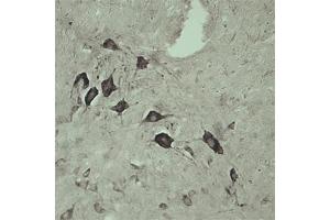 IHC on rat spinal cord using Rabbit antibody to internal part of Vacuolar protein sorting-associated protein 45 (rvps45, Vps45, Vps45a): IgG (ABIN351329) at a concentration of 10 µg/ml.