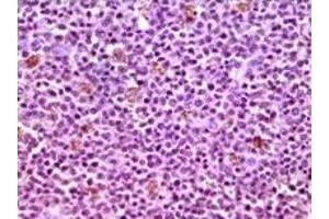 Immunohistochemistry (IHC) image for anti-Induced Myeloid Leukemia Cell Differentiation Protein Mcl-1 (MCL1) antibody (ABIN2464081) (MCL-1 antibody)