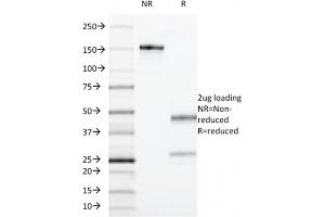 SDS-PAGE Analysis Purified CD55 Mouse Monoclonal Antibody (F4-29D9) . (CD55 antibody)