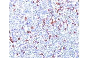Formalin/paraffin human tonsil stained with Kappa light chain antibody (L1C1). (Mouse anti-Human kappa Light Chain Antibody)