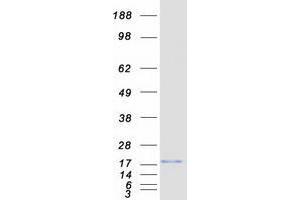 Validation with Western Blot (VAMP4 Protein (Myc-DYKDDDDK Tag))