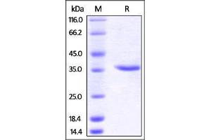 Human Carbonic Anhydrase IX (138-414), His Tag on SDS-PAGE under reducing (R) condition. (CA9 Protein (AA 138-414) (His tag))