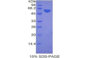 SDS-PAGE analysis of Mouse ANP32A Protein. (PHAP1 Protein)