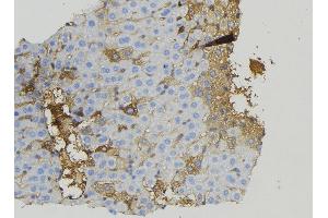 ABIN6274923 at 1/100 staining Mouse liver tissue by IHC-P. (BRP44L antibody  (Internal Region))