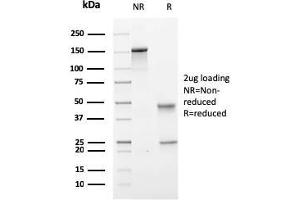 SDS-PAGE Analysis Purified PMEPA1 Mouse Monoclonal Antibody (PMEPA1/2697). (PMEPA1 antibody)