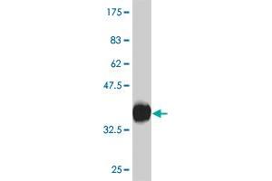 Western Blot detection against Immunogen (30. (CXCR4 antibody  (AA 1-46))