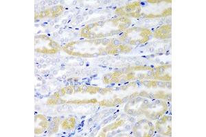 Immunohistochemistry of paraffin-embedded mouse kidney using FABP6 antibody at dilution of 1:200 (40x lens).