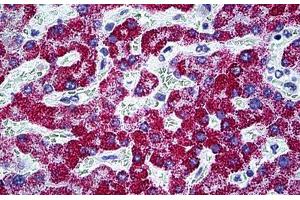 Human Liver: Formalin-Fixed, Paraffin-Embedded (FFPE) (CPS1 antibody  (AA 1400-1501))