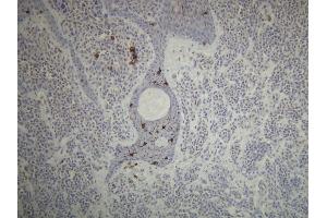 Immunohistochemistry (IHC) image for anti-CD1a (CD1a) (AA 240-256), (C-Term) antibody (ABIN870499) (CD1a antibody  (C-Term))