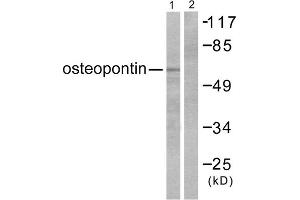 Western blot analysis of extracts from LOVO cells, using osteopontin antibody (ABIN5976474). (Osteopontin antibody  (C-Term))