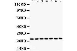 Western Blotting (WB) image for anti-Glutathione S-Transferase pi 1 (GSTP1) (AA 2-210) antibody (ABIN3042437) (GSTP1 antibody  (AA 2-210))