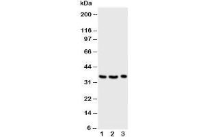 Western blot testing of Granzyme A antibody and Lane 1:  Jurkat;  2: CEM;  3: Raji cell lysate