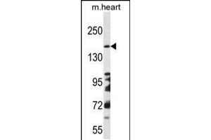 Western blot analysis in mouse heart tissue lysates (35ug/lane). (DCC antibody  (AA 643-670))